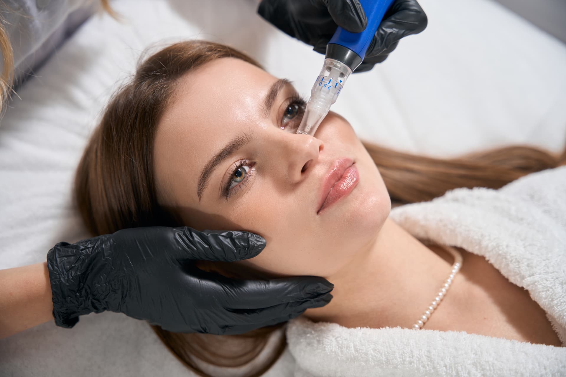 Microneedling mit SkinPen®