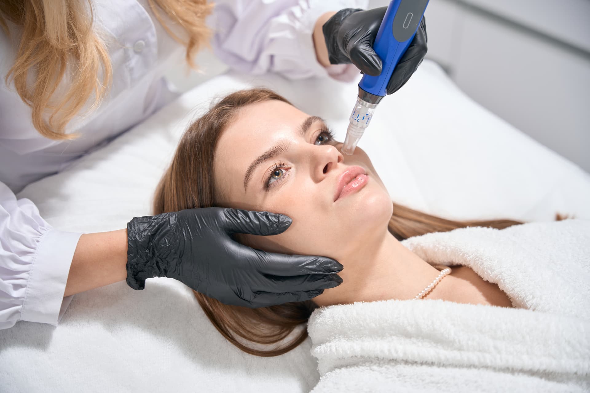 Microneedling-Behandlung mit einem Pen